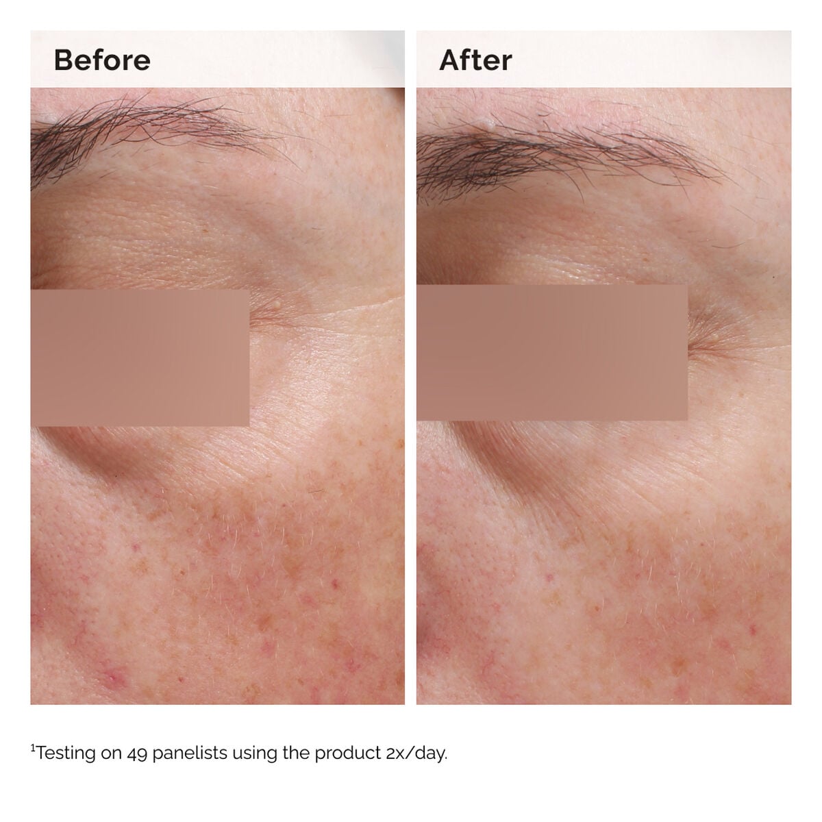 niacinamide-5-face-and-body-emulsion-k3 2024-08-23-ORD-Nia-5pct-Face-Body-B-A-Elasticity-Global-02-1x1.jpg