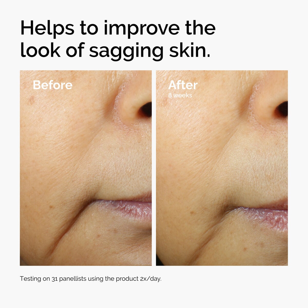 caffeine-3-escin-1-face-serum-r3 ord-caffeine-3pct-escin-1pct-face-serum-before-after-sagging.jpg