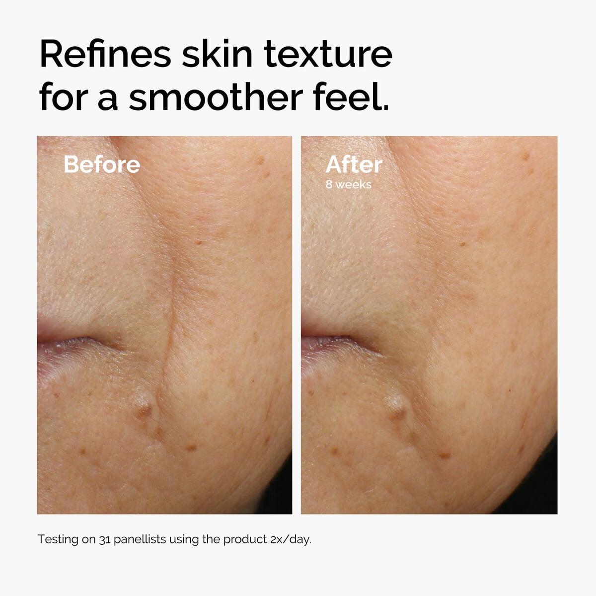 caffeine-3-escin-1-face-serum-r3 ord-caffeine-3pct-escin-1pct-face-serum-before-after-texture.jpg