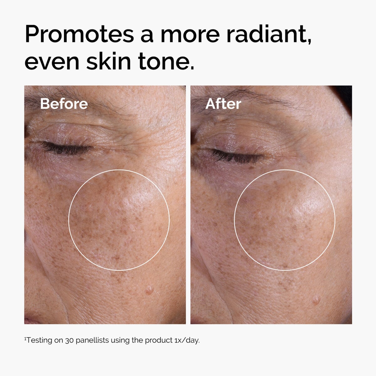 glycolic-acid-7-exfoliating-toner-v1 ord-glycolic-before-after-radiance.jpg