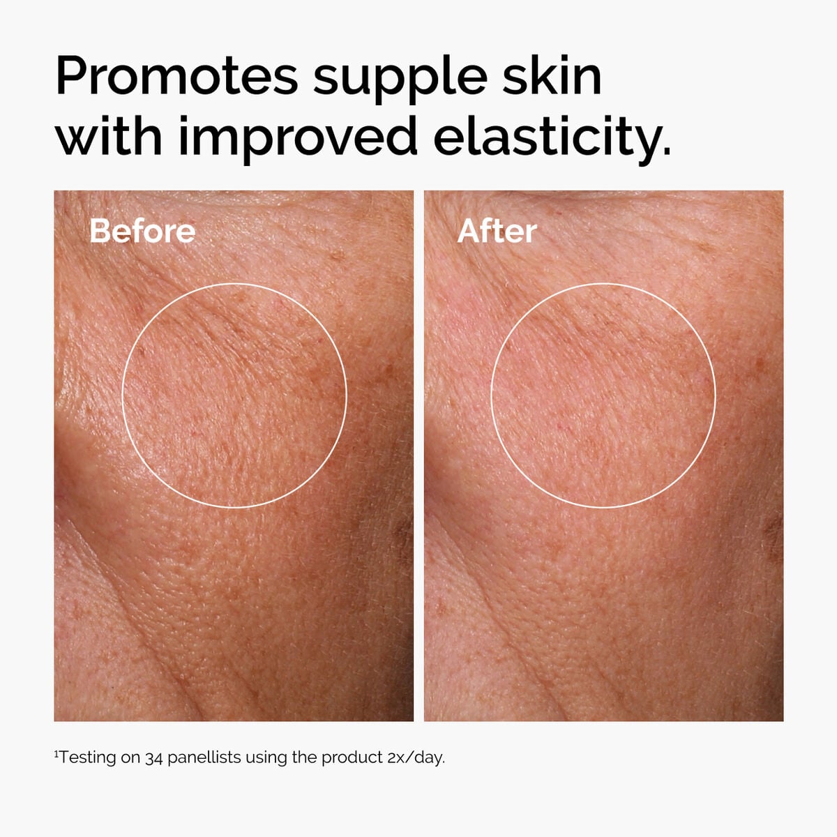 hyaluronic-acid-2-b5-with-ceramides-s9 ord-hyaluronic-acid-2pct-b5-hydrating-serum-before-after-elasticity.jpg