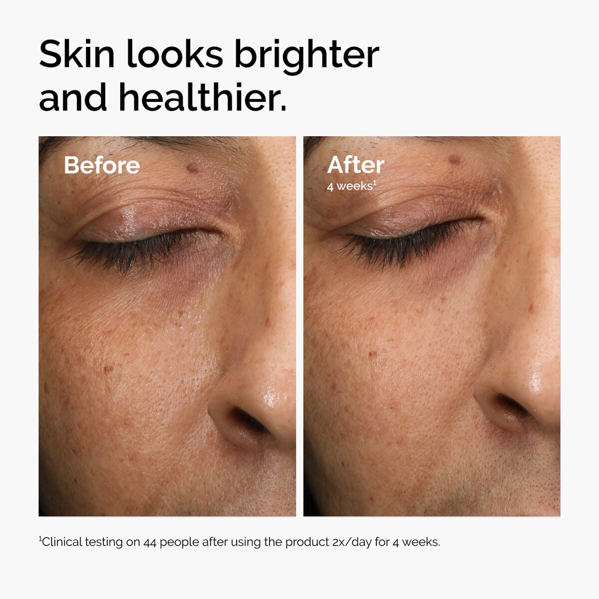 multi-antioxidant-radiance-serum-t8 ord-mars-before-after-healthy.jpg
