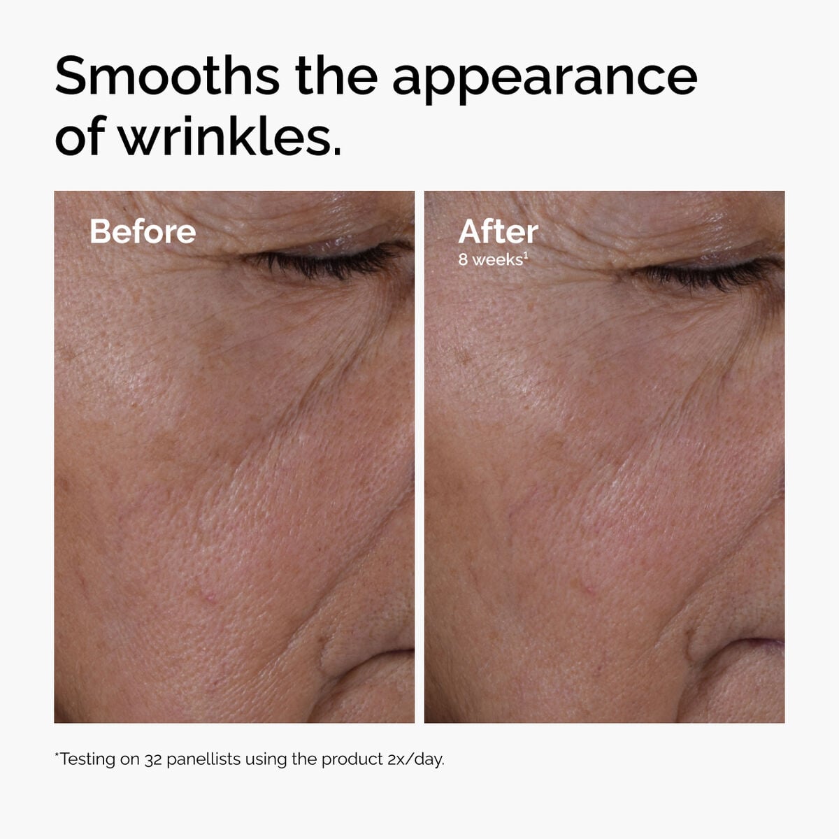 multi-peptide-ha-serum-v0 ord-multi-peptide-ha-serum-wrinkles-before-after.jpg