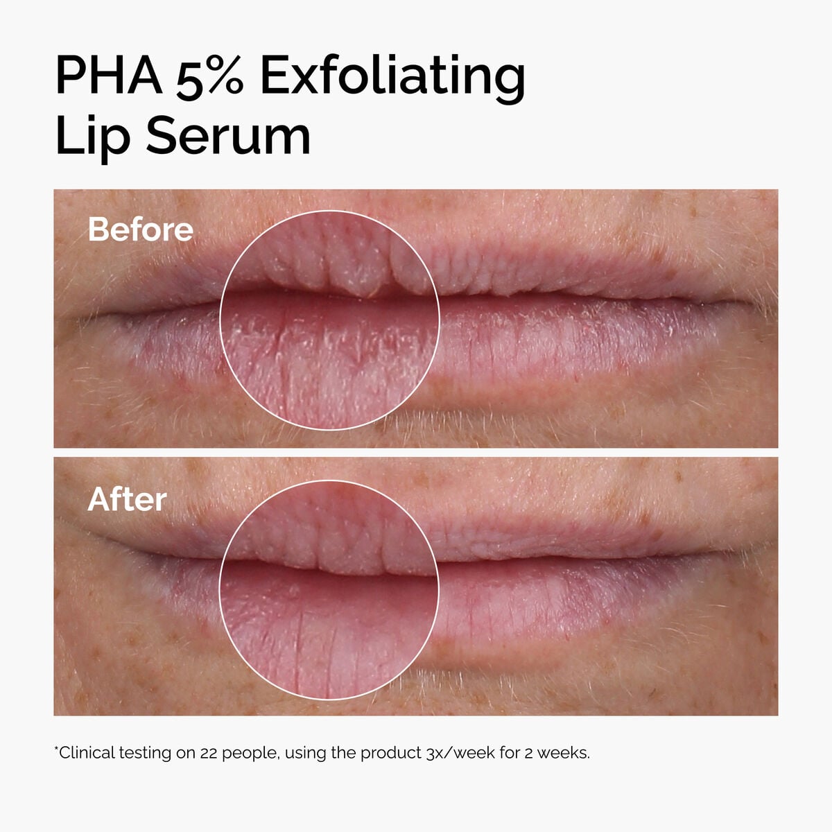 pha-5-exfoliating-lip-serum-h8 ord-pha-5pct-lip-exfoliating-serum-before-after.jpg