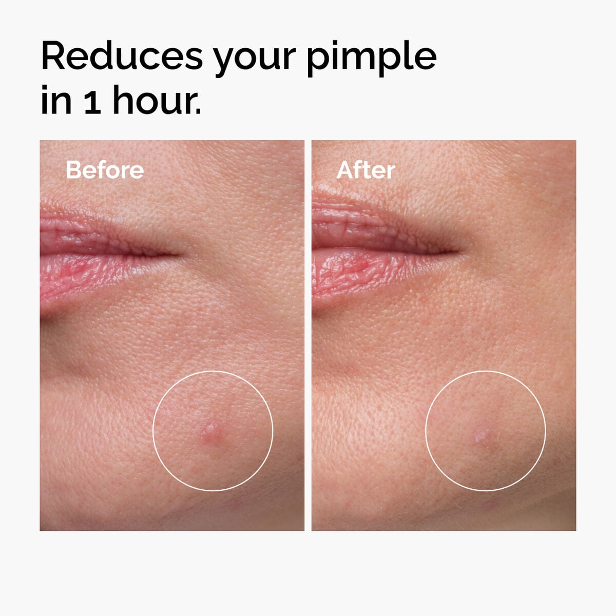 sulfur-10-powder-to-cream-concentrate-y4 ord-sulfur-10pct-powder-to-cream-concentrate-before-after-NA.jpg